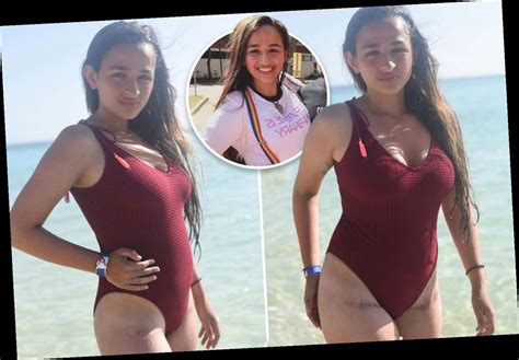 I Am Jazzs Jazz Jennings Reveals Gender Confirmation Surgery Scars In