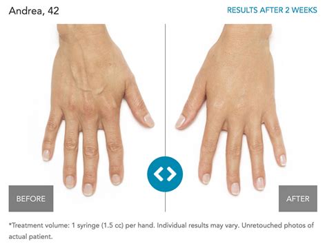 Christine Hamori Cosmetic Surgery Skin Spa Blog By Dr Christine Hamori Md Hand