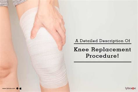 A Detailed Description Of Knee Replacement Procedure By Dr Akash J