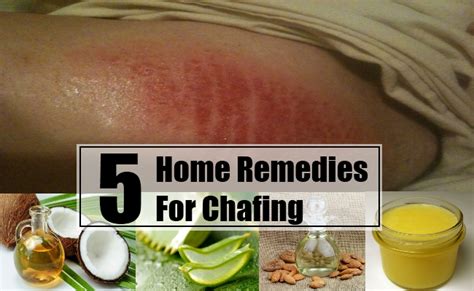 Chafing Home Remedies Natural Treatments And Cure Search Home Remedy