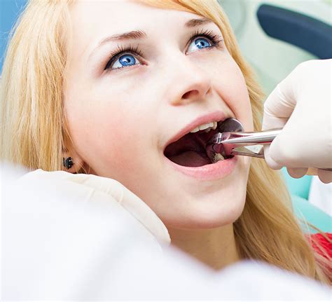 Estrazione Del Dente Odontoiatria Chirurgica Udental