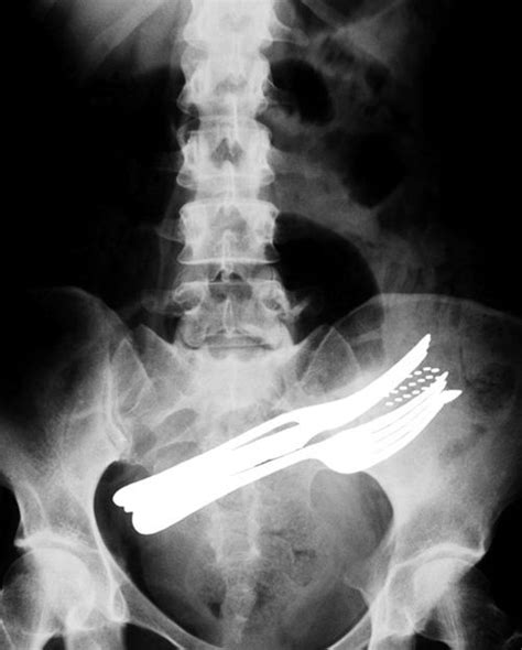 20 of the world s most bizarre x rays x ray weird pictures bizarre