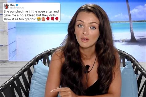 Kady Mcdermott Reveals She Was Punched In The Face And Left With