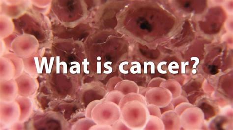 Cancer Symptoms Causes And Associated Risk Factors Healthy Living