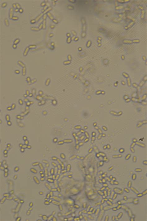 It is important to mention that cell culture must be conducted under very strict aseptic conditions as microbial contamination can be frustrating and lead to a waste. What kind of infection (in cell culture) is this?