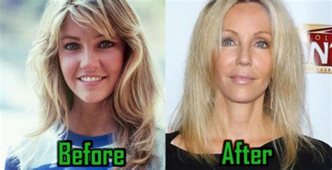 Heather Locklear Plastic Surgery Facelift Boob Job Before After