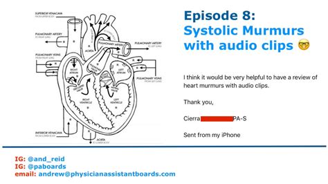 episode8 systolic murmurs with audio clips youtube