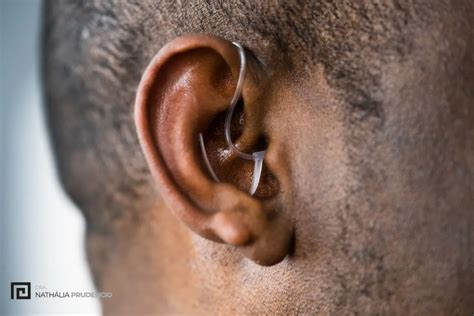 Como Tratar O Zumbido No Ouvido Os Principais Tratamentos
