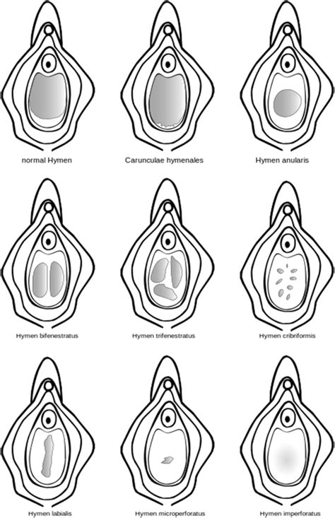 shows some of the different configurations of the hymen download scientific diagram