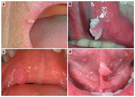 Oral Free Full Text Commonalities Between ENT Specialists And Oral