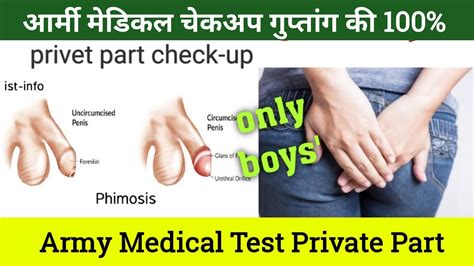 Indian Army Medical Test Private Part Privet Part Check Up In Army Full Details Youtube