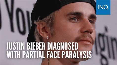 Justin Bieber Diagnosed With Partial Face Paralysis Youtube