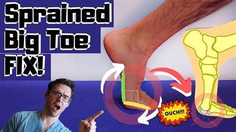 Best Sprained Big Toe Joint Treatment Turf Toe Treatment And Exercises