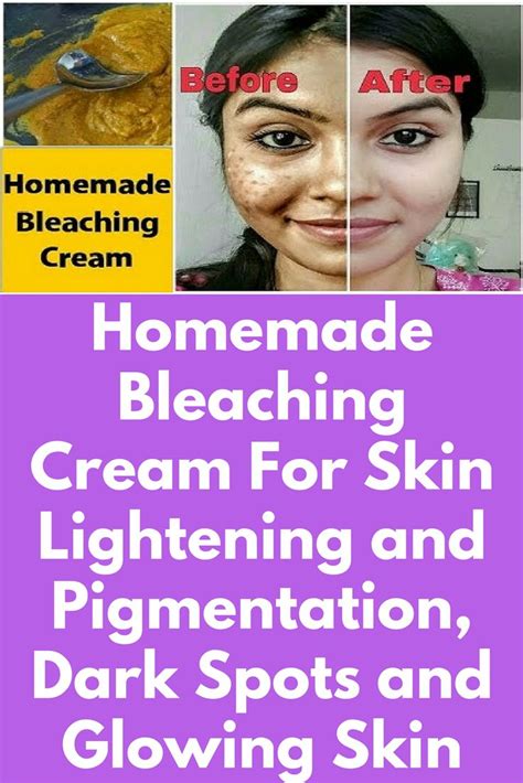 How To Bleach Your Skin At Home Easy