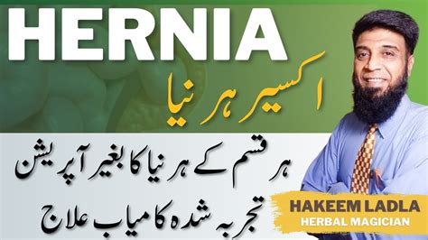 Hernia Treatment Without Surgery At Home Hernia Ka Bina Operation Ka