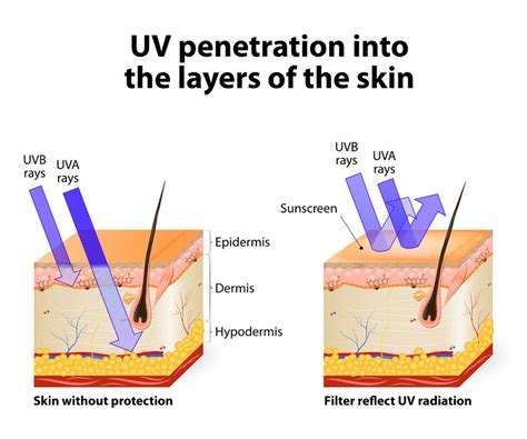 Ultraviolet Uv Radiation Aim At Melanoma Foundation