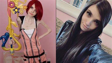 The Harsh Reality Of Eating Disorders Eugenia Cooney S Before And After