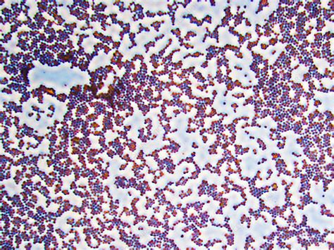 Staphylococcus Aureus Bacteria Stock Image B2340144 Science