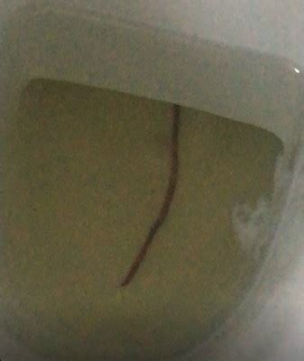 Maybe you would like to learn more about one of these? Worm Found in Toilet is Harmless Earthworm - All About Worms