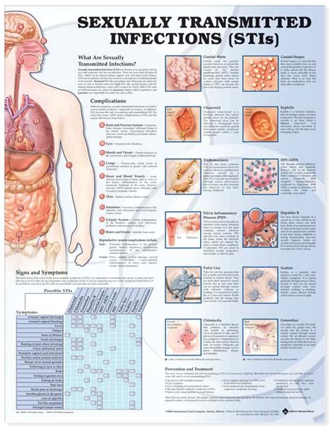 Anatomical Chart Series Sexually Transmitted Infections Stis