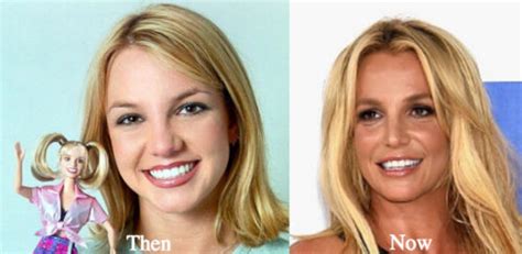 Britney Spears Plastic Surgery Before And After Photos