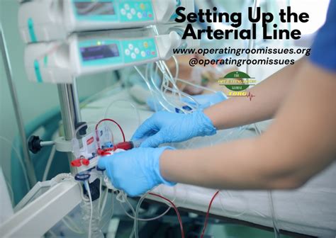 How To Set Up An Arterial Line Detailed Explanation The Operating
