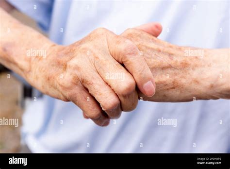 Hands Skin Aging Hand Skins Stock Photo Alamy