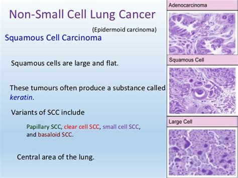 Non Small Cell Cancer Of The Lung