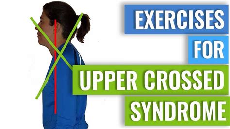 Exercises To Correct Upper Crossed Syndrome Youtube