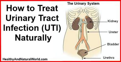 How To Treat Urinary Tract Infection UTI Naturally