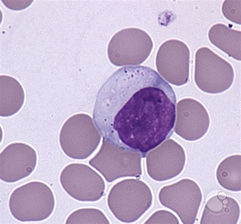 38 Best Hemoteca Images On Pinterest Hematology Labs And Blood Cells