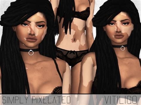 Vitiligo Overlay By Simplypixelated At Tsr Sims 4 Updates