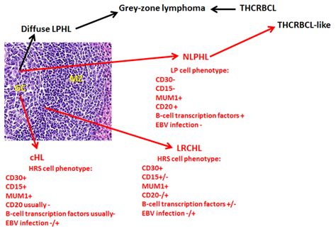 Classification Of Hodgkin Lymphoma Over Years