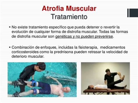 Problemas Musculares