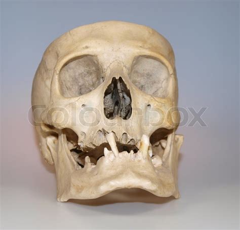 Real Human Skull Used Like Teaching Stock Photo Colourbox