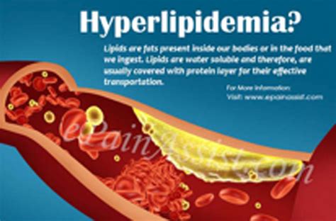Hiperlipidemia Co To Jest Rodzaje Przyczyny Objawy Leczenie I My Xxx