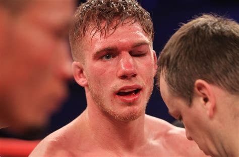 Nick Blackwell Update Boxer To Be Brought Out Of Coma In Next 24 Hours Metro News