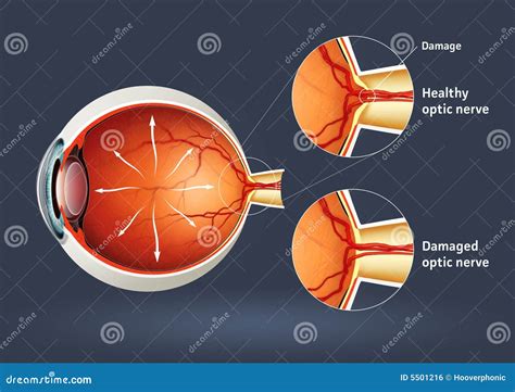 Retinal Cartoons Illustrations And Vector Stock Images 3559 Pictures