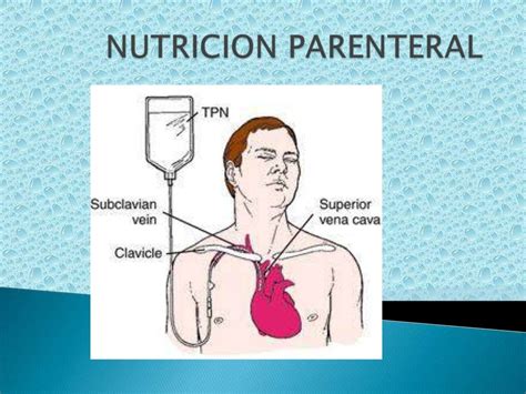 Diferencie Nutrição Enteral E Parenteral