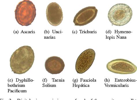 Automatic Identification Of Human Parasite Eggs Based On Multitexton