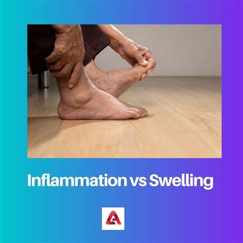 Inflammation Vs Swelling Difference And Comparison