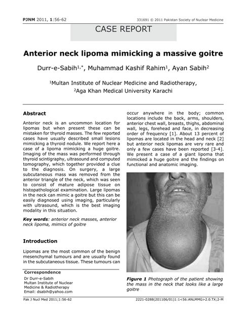 Pdf Anterior Neck Lipoma Mimicking A Massive Goitre