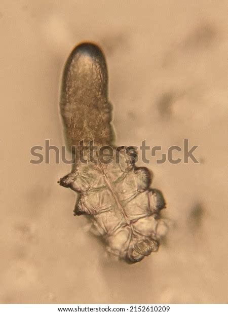 Photo Demodex Face Mites Under Microscope Stock Photo Shutterstock