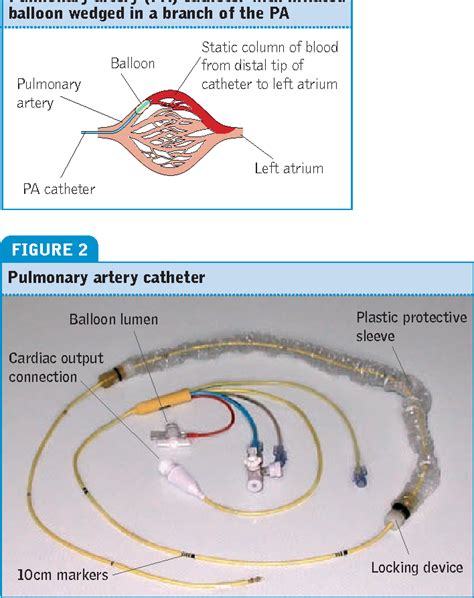 Figure 5 From A Practical Guide To Using Pulmonary Artery Catheters