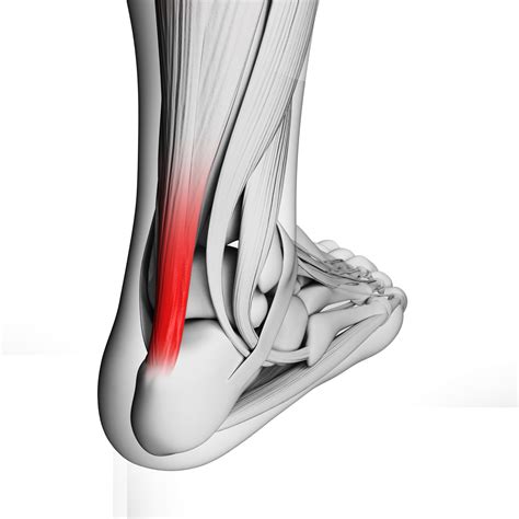 Pain In The Achilles Tendon Center Grove Foot And Ankle Care