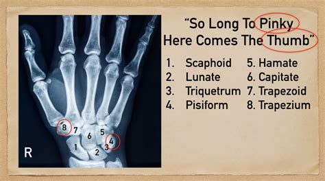 Carpal Bone Mnemonic And Names Wrist Anatomy Made Easy — Ezmed