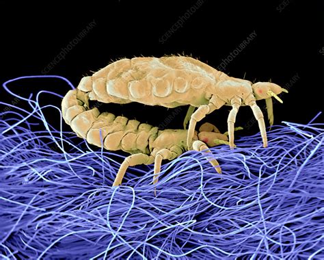 Mating Body Lice Sem Stock Image Z2650123 Science Photo Library