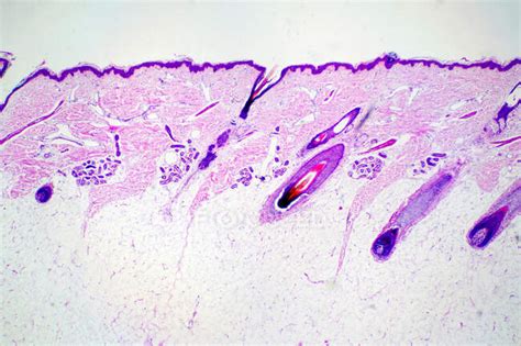 Cross Section Of Human Scalp Tissue Light Micrograph — Anatomy