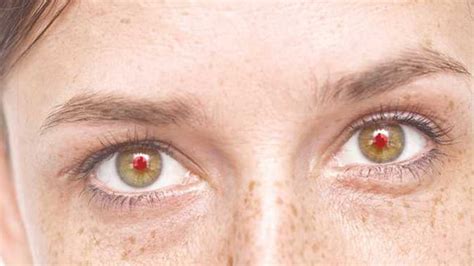 ¿cuál Es La Causa De Los Ojos Rojos En La Fotografía