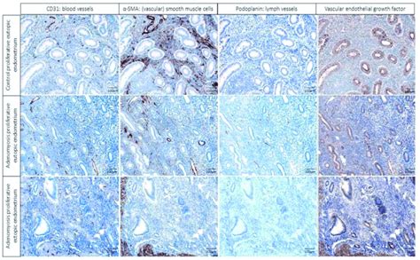 Representative Images Of The Individual Ihc Markers Using The Pathology